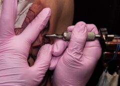 Zalety nowoczesnych metod usuwania wzorów skórnych